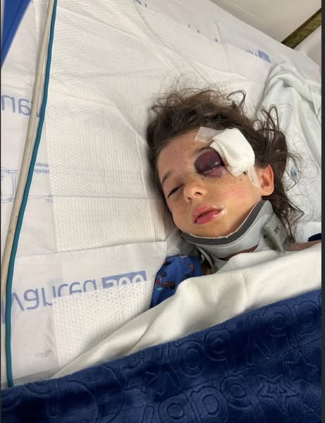 Sophia Martinez Canyon Lake Near-Fatal Accident: Sophia Martinez 9-Year-Old Airlifted with Brain Bleed After Being Hit by Bat: Faces Reconstructive Surgery on Birthday Week